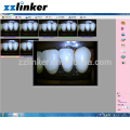 Dental Intraoral Kamera mit 17inch Touchscreen Monitor und LCD Klemme